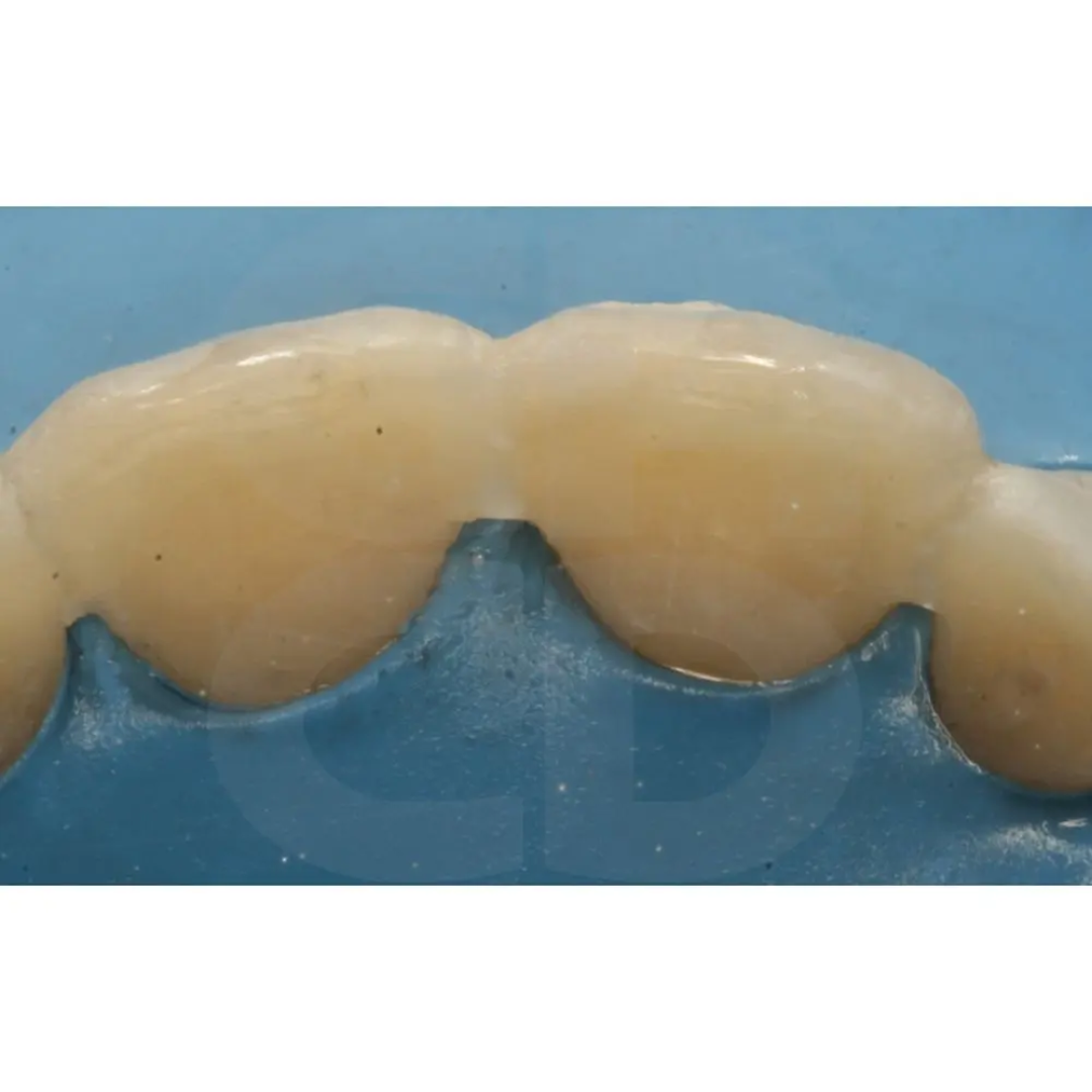 Brush-Dip - Starter Kit-1