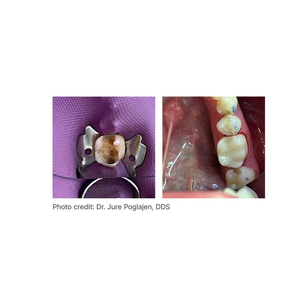 Predicta® Bioactive Bulk-2